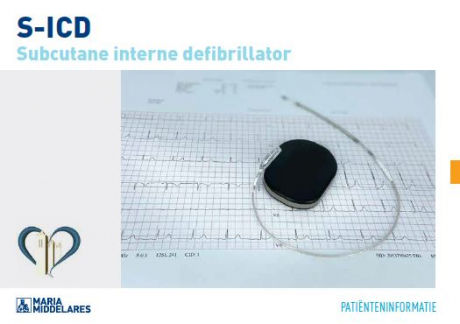 subcutane defibrillator
