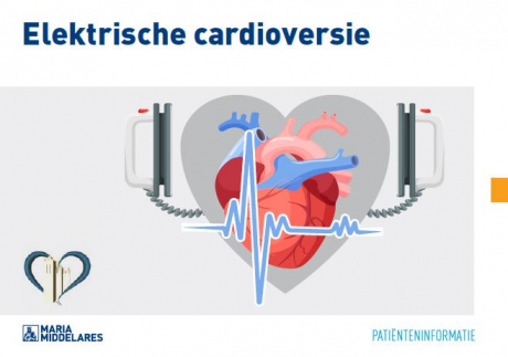 Elektrische cardioversie
