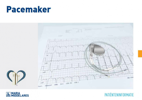Pacemaker implantatie